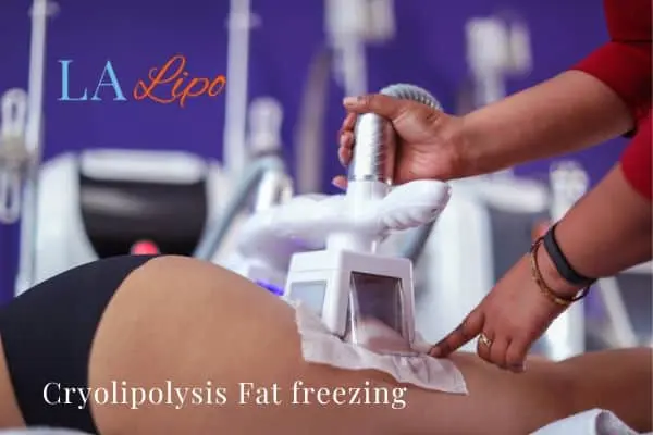 women getting fat freezing Bournville