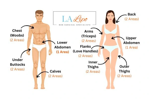 LA LIPO Cryolipolysis Areas Bournville