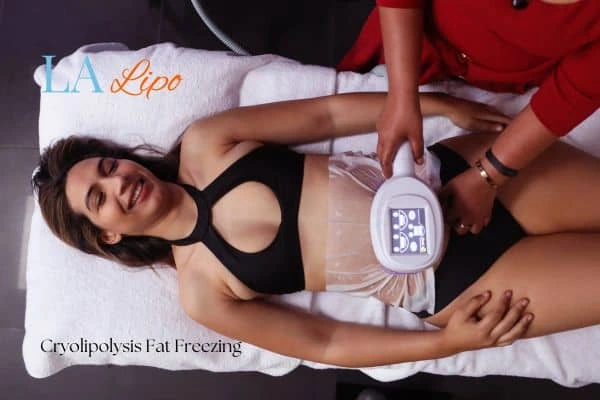 woman getting cryolipolysis Bournville