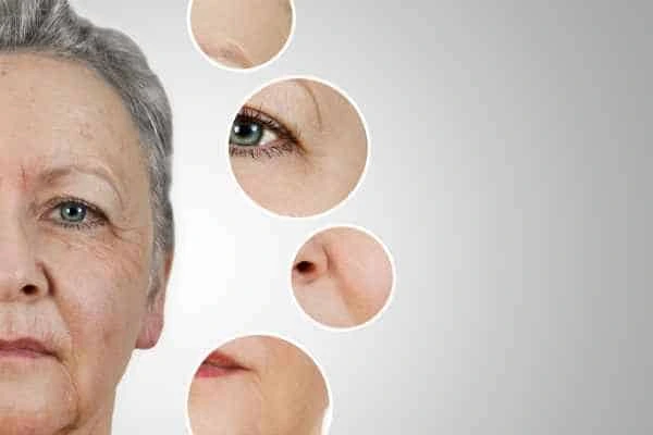 HIFU Facelift Bournville from LA LIPO