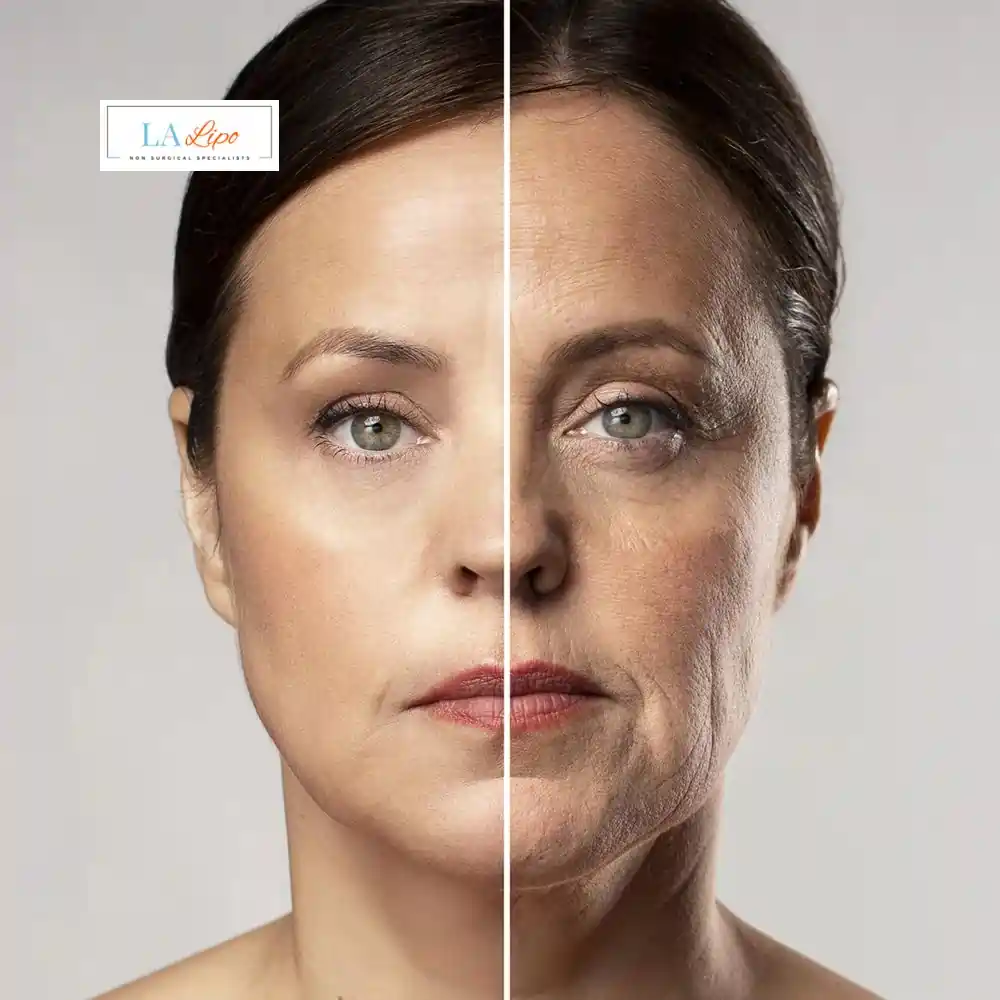 How Can You Tell If Non-Surgical Skin Tightening Is Right for You Bournville?