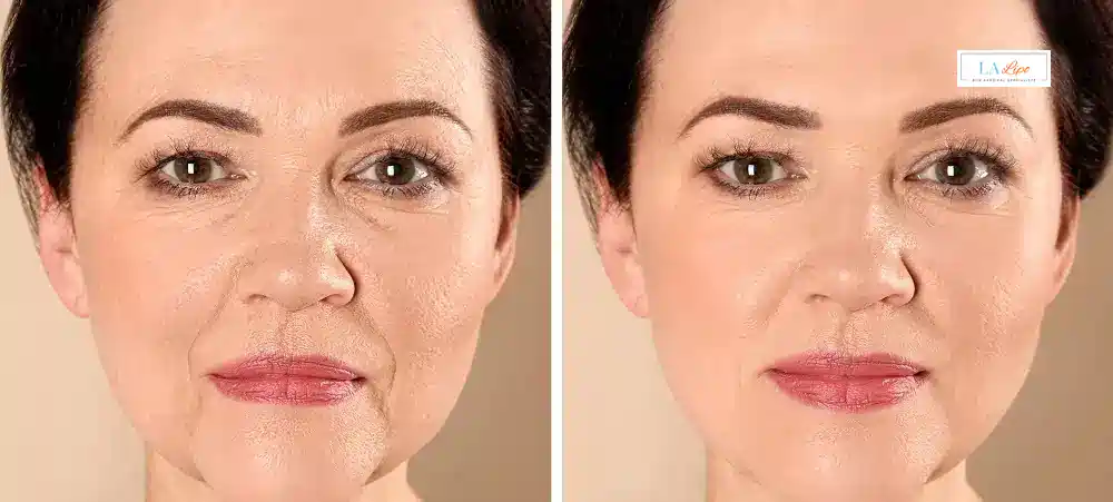 How Long Does It Take to See Results and How Long Do They Last Bournville?