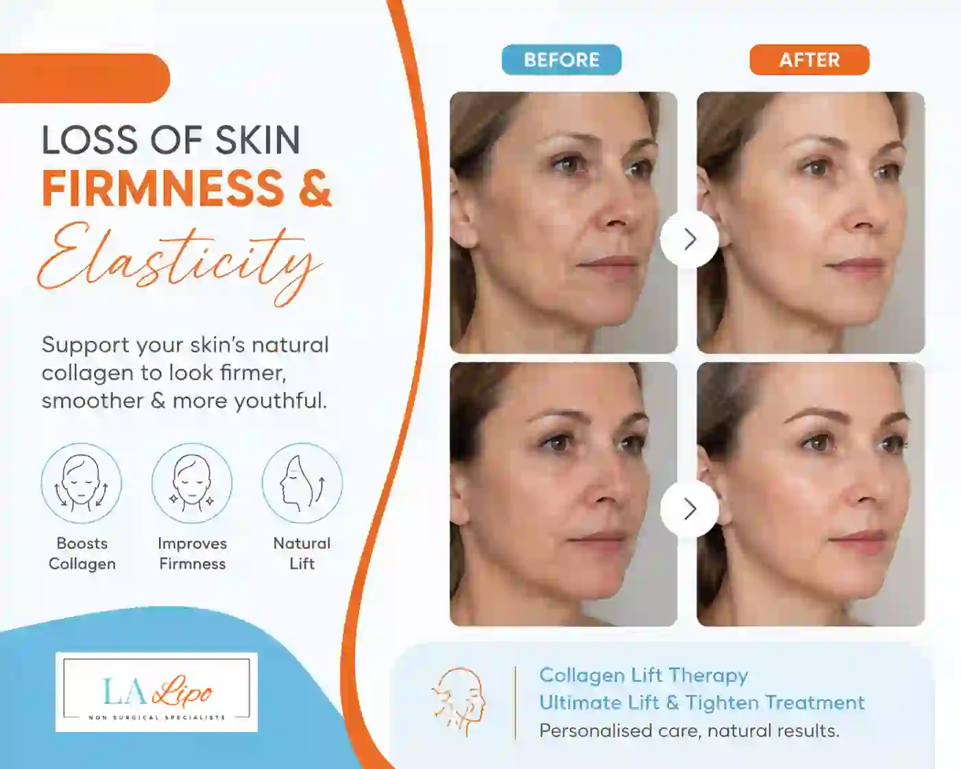 Sign #7: Loss of Skin Firmness and Elasticity Bournville